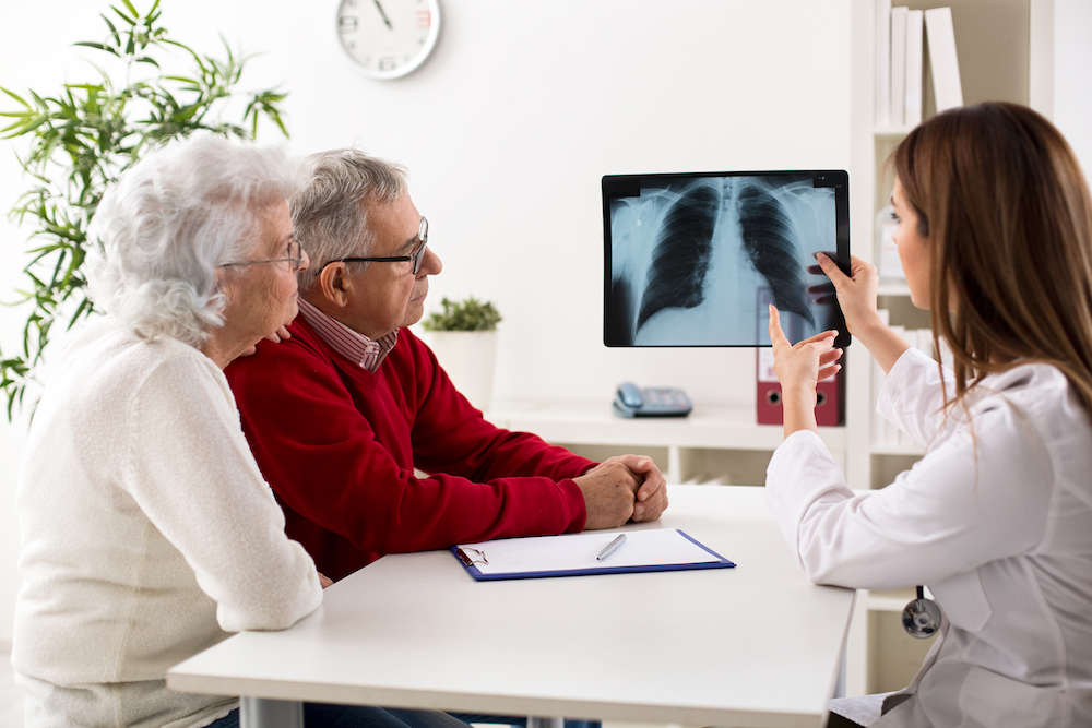 Doctor showing couple xray of chest